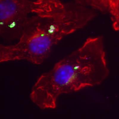 GBps Proteins Kill Bacteria With Antimicrobial Sacs (3 of 4)