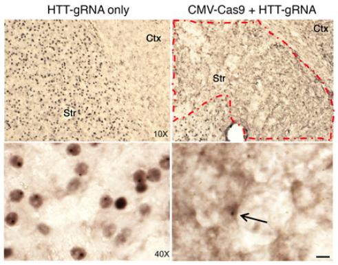 HD Protein Aggregates