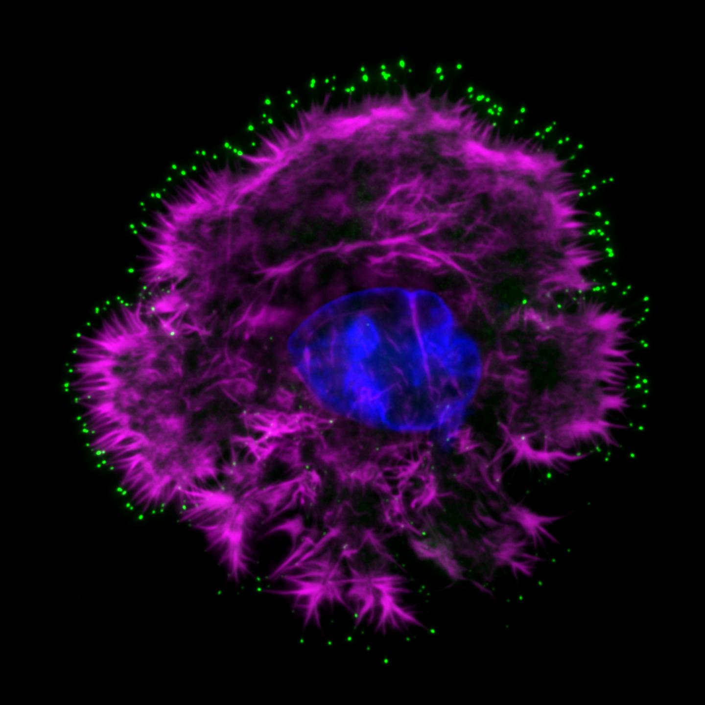 High-Resolution Microscope Image of an Invasive Breast Cancer Cell