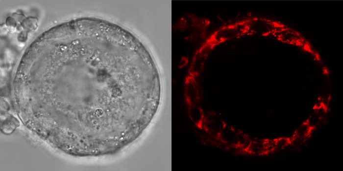 Absence of reactive oxygen species shown in oocytes