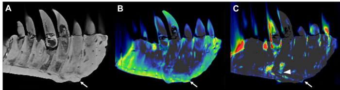 CT Uncovers Bone Disease in Tyrannosaurus Rex Jaw