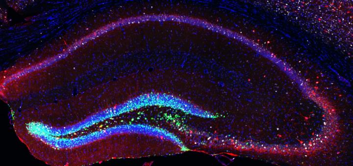 Image of Neural Stem Cells and Newborn Neurons of the Mouse Brain