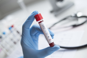 HIV positive blood sample