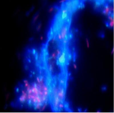 Cyanobacterium Showing Cellulose