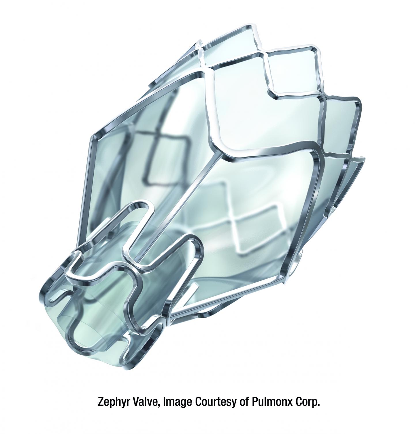 Zephyr Valve