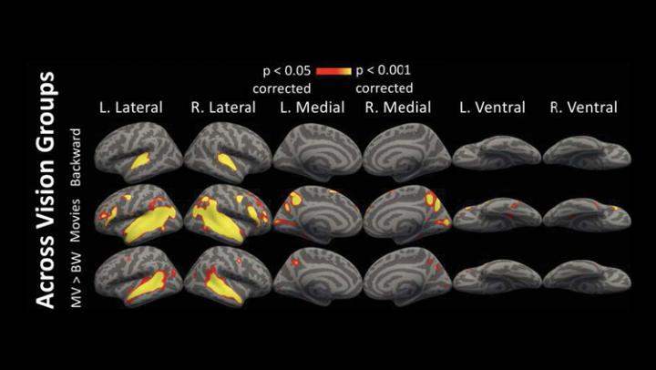 Visual Cortex Activation