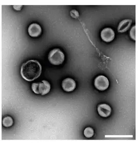 Electron micrograph of engineered extracellular vesicles at a magnification of 23,000×