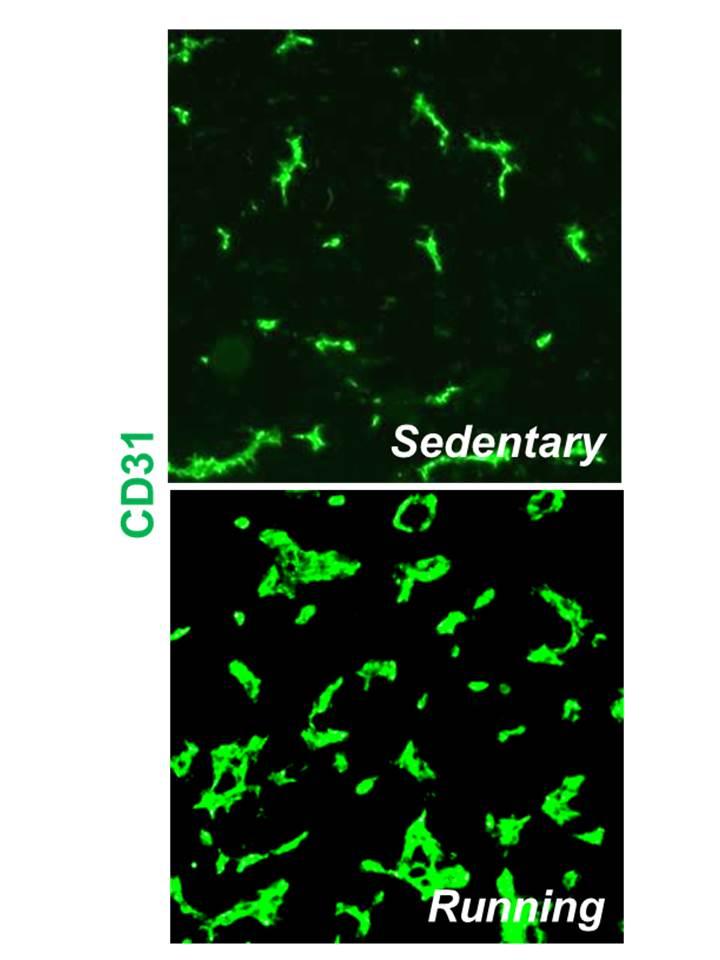 Green Dye Identifies Tumor Blood Vessels