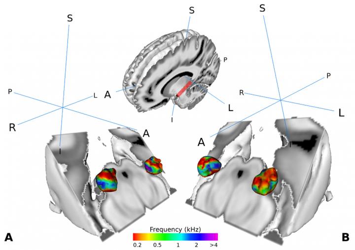 Medial Geniculate Body (MGB)