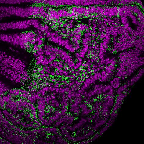 Overgrown Drosophila wing epithelium subjected to chromosomal instability