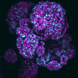 Human fetal pancreatic organoid with acinar cells