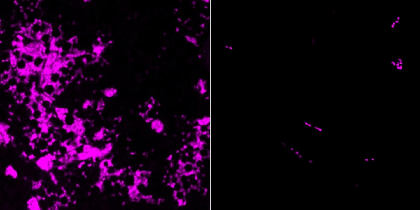 Difference between IFN and TNF