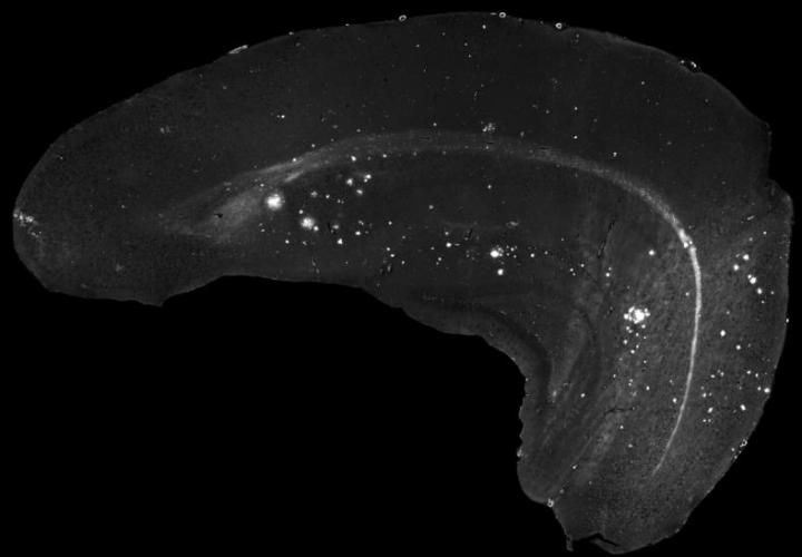 Age-Related Deposits of Amyloid-Beta Protein in the Brain