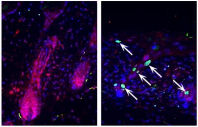 Loss of TumorSuppressor and D IMAGE Biology Diagrams