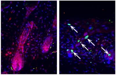 Loss of Tumor-Suppressor and DNA-Maintenance Proteins