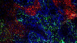 Skin cells at the edge of a diabetic wound