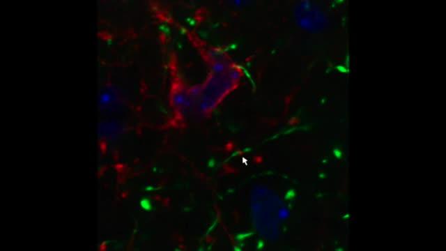 The Brain Cells that Aid in Appetite Control
