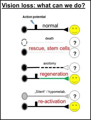 Vision Loss: What Can We Do?