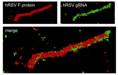 RSV Viral Filament