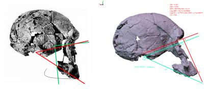 1.9 Million-year-old Early Human Skull