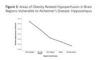 Areas of Obesity-Related Hypoperfusion in Brain Regions