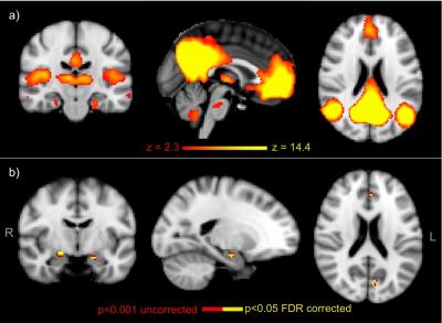 FMRI Analysis of Brain Network Activity for the Volunteers While at 'Rest'