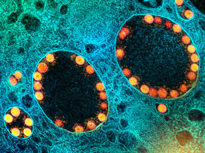 SARS-CoV-2 virus particles