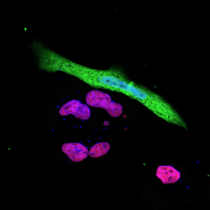 Suppression of NLRC5 in SARS-CoV-2-infected cells