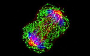 Breast Cancer Cell