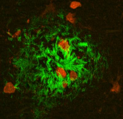 Next-Generation Rat Model of Alzheimer's Disease