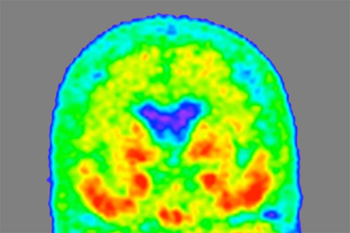 Heat map of tau