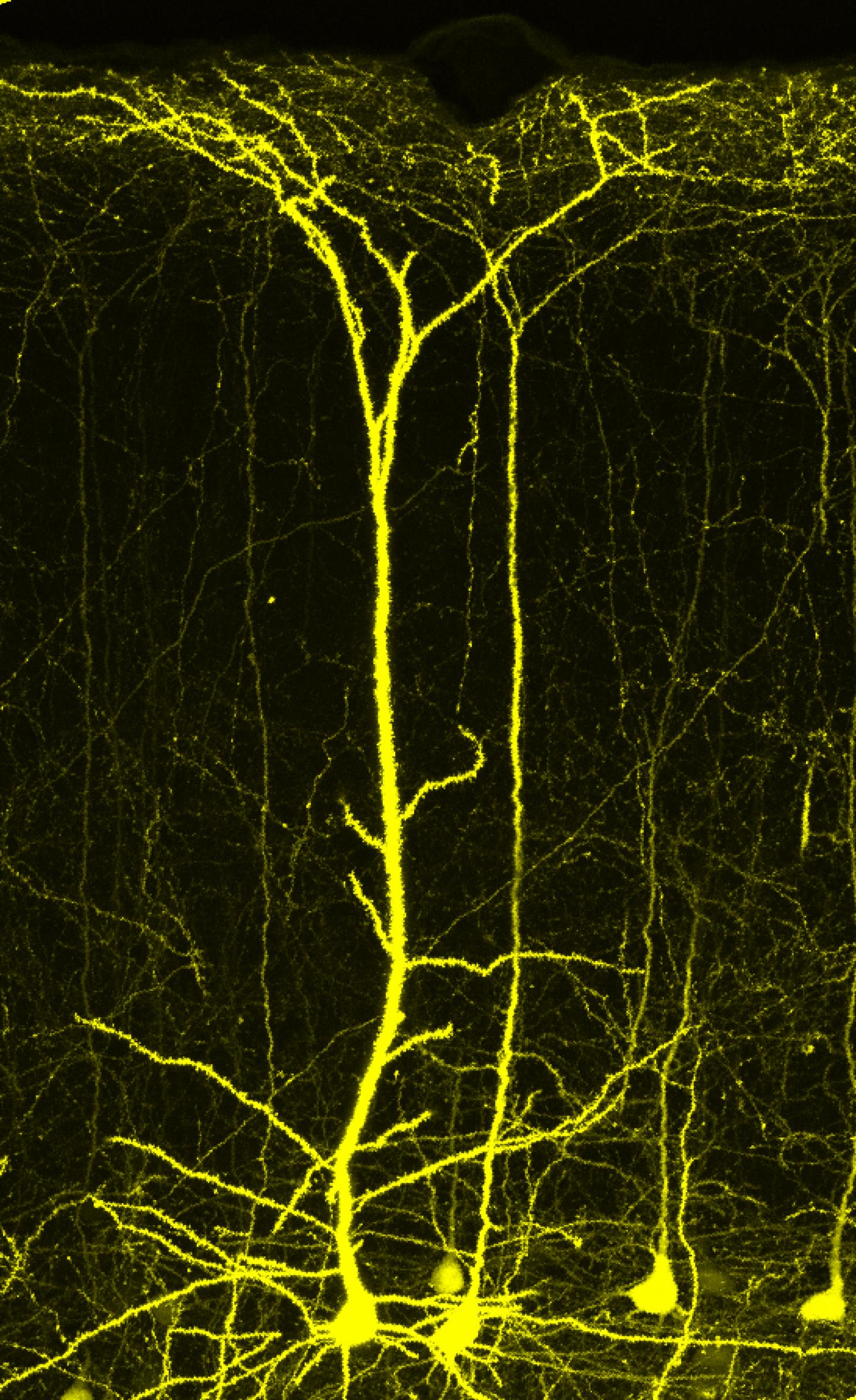 Unlocking a Youthful Brain (1 [IMAGE] | EurekAlert! Science News Releases
