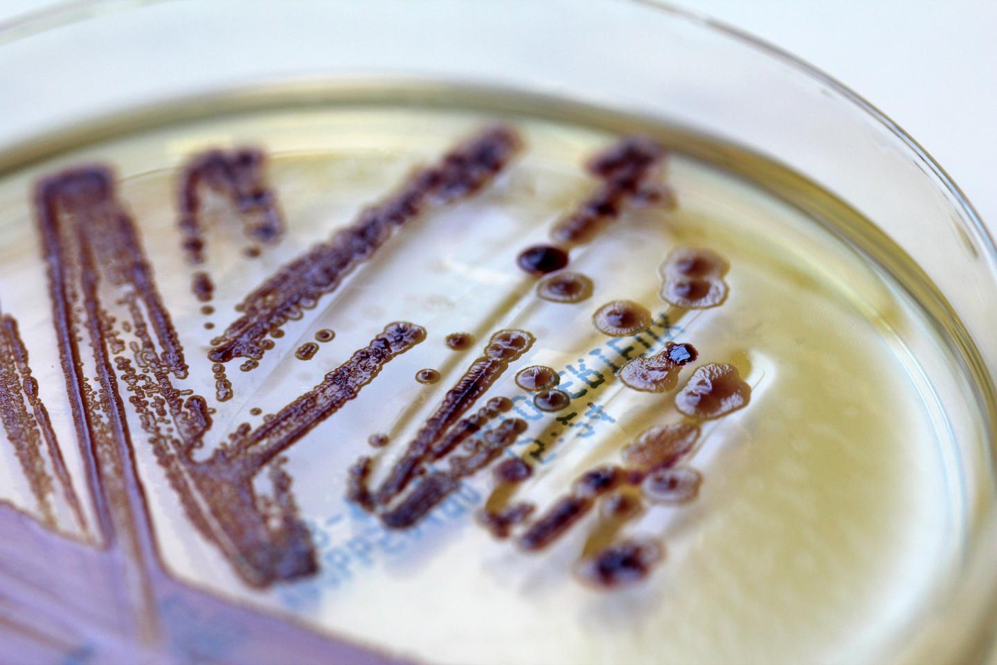 <i>E. coli</i> in a Petri Dish