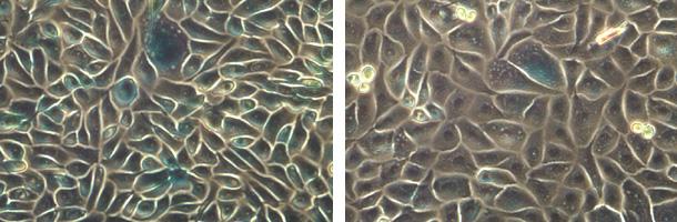 Ras-induced Senescence