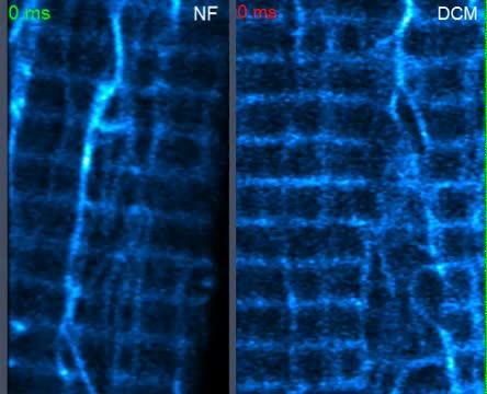 Comparing Beating Heart Muscle Cells