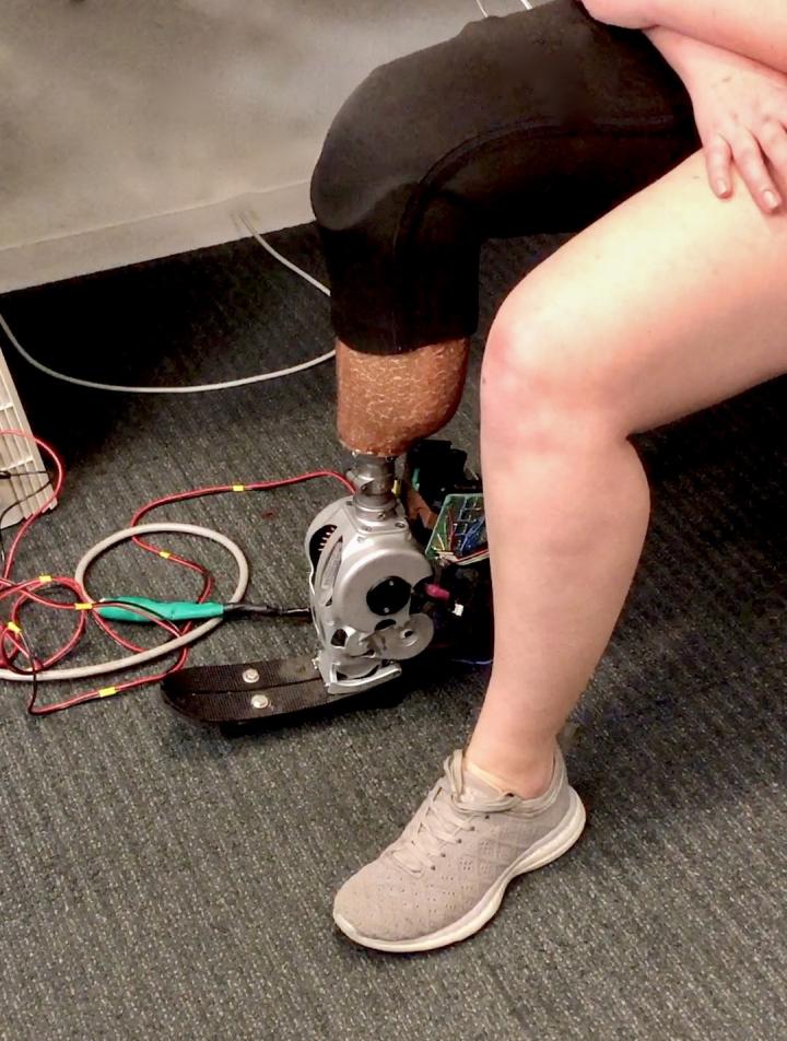 The AMI amputation enables better motor signal production to control bionic prostheses.