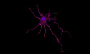 RNA Gas5 in primary cortical neurons