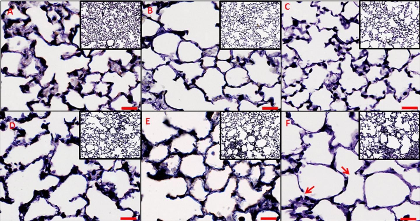 New Virtual Model Reveals Details of Declining Lung Function in Mice
