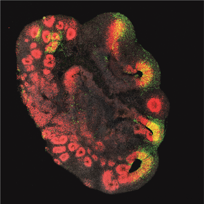 Brain organoid