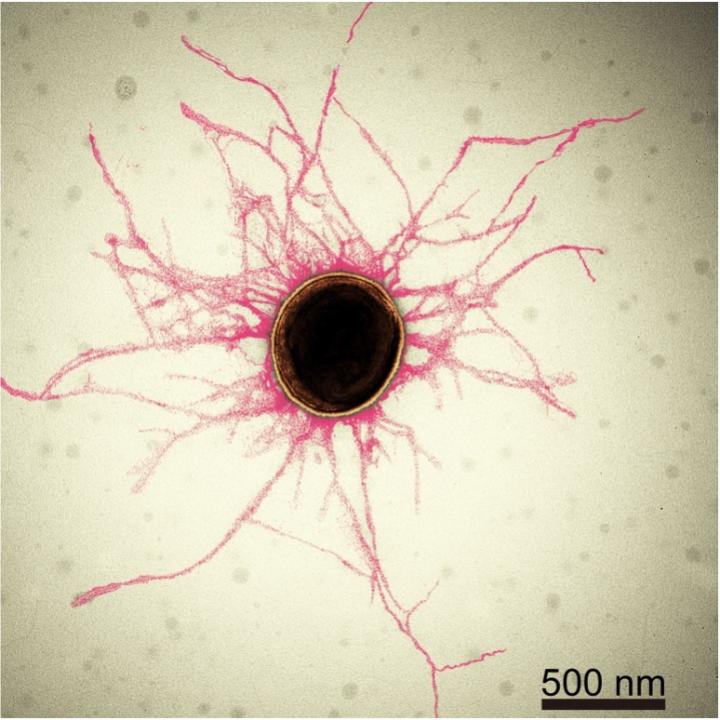 An Artistically Colored Electron-Microscopic Image of a Porphyromonas Gingivalis Cell