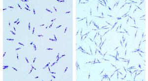 Co-infection by novel species of parasite