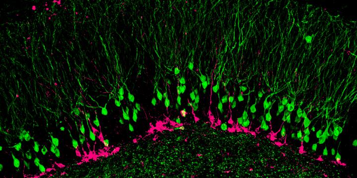 Neurons in the Hippocampus