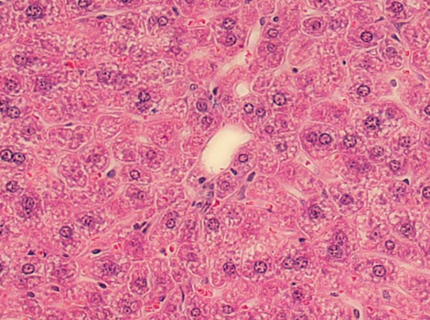 HE-OX40 Treatment Can not Induces Hepatitis in Casp KO Mice