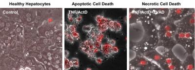 New Study Questions the Safety of Caspase Inhibitors for the Treatment of Liver Disease