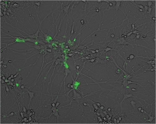 EBV in Neurons