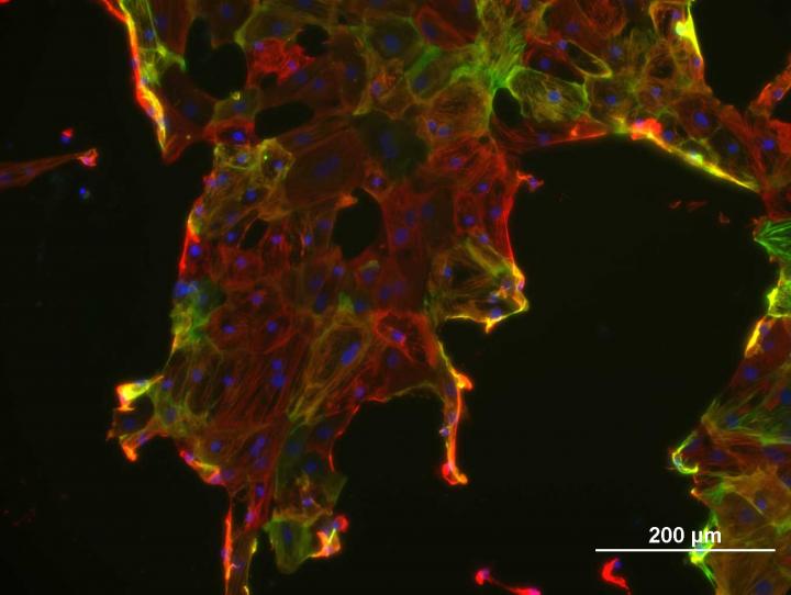 Cardiomyocytes Post-Mitochondrial Replacement Therapy