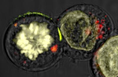 Natural Killer Cell in Action (1 of 2)