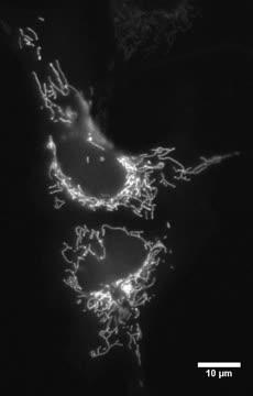 Fluorescence-Activating Beta Barrel Protein