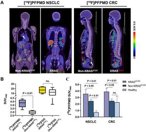 18F-PFPMD PET/CT imaging of NSCLC and CRC patients.