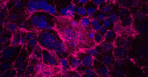 Tumor-initating cells matrix fibronectin